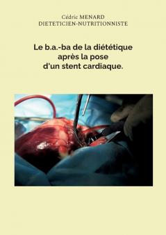 Le b.a.-ba de la diététique après la pose d'un stent cardiaque.