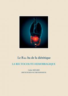 Le B.a.-ba de la diététique de la rectocolite hémorragique