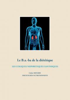 Le b.a-ba de la diététique pour les coliques néphrétiques xanthiques