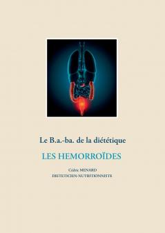 Le b.a-ba de la diététique pour les hémorroïdes