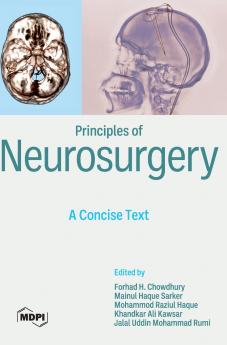 Principles of Neurosurgery