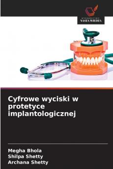 Cyfrowe wyciski w protetyce implantologicznej