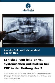 Schicksal von lokalen vs. systemischen Antibiotika bei PRF in der Heilung des 3
