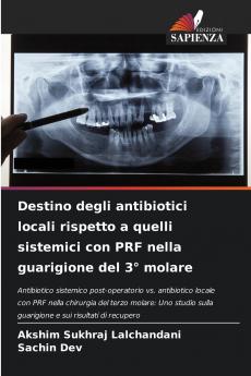 Destino degli antibiotici locali rispetto a quelli sistemici con PRF nella guarigione del 3° molare