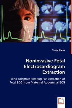 Noninvasive Fetal Electrocardiogram Extraction