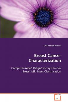 Breast Cancer Characterization  Computer-Aided Diagnostic System for Breast MRI Mass Classification