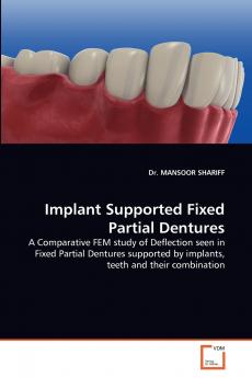 Implant Supported Fixed Partial Dentures