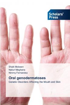 Oral genodermatoses