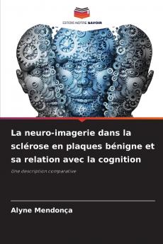 La neuro-imagerie dans la sclérose en plaques bénigne et sa relation avec la cognition