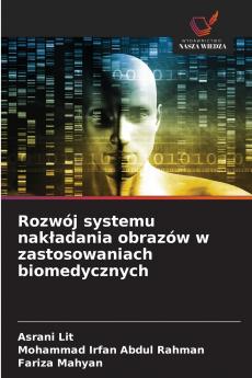 Rozwój systemu nakładania obrazów w zastosowaniach biomedycznych