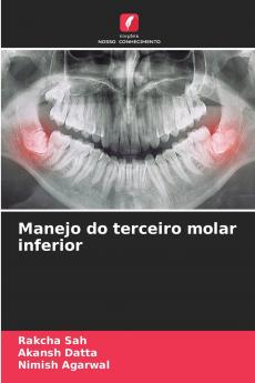 Manejo do terceiro molar inferior