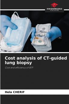Cost analysis of CT-guided lung biopsy