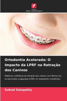 Ortodontia Acelerada