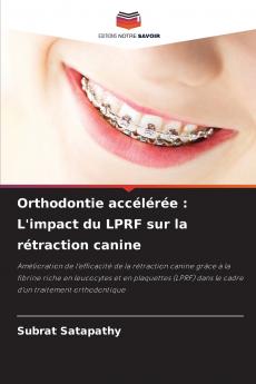 Orthodontie accélérée