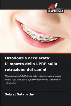 Ortodonzia accelerata