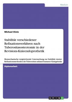 Stabilität verschiedener Refixationsverfahren nach Tuberositasosteotomie in der Revisions-Knieendoprothetik