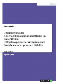 Untersuchung der Knochen/Implantat-Kontaktfläche im zementfreien Hüftgelenkpfannenersatzsystem zum Erreichen einer optimalen Stabilität