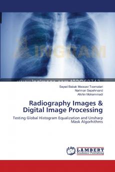 Radiography Images & Digital Image Processing