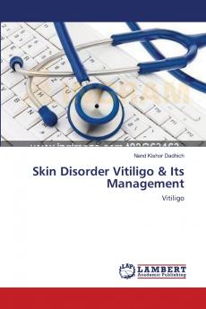 Skin Disorder Vitiligo & Its Management