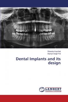 Dental Implants and Its Design