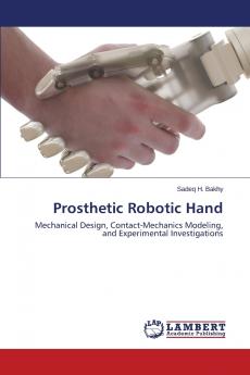 Prosthetic Robotic Hand