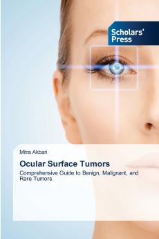 Ocular Surface Tumors