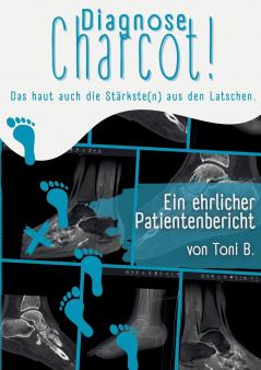 Diagnose Charcot!