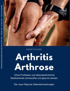Arthritis - Arthrose. Ohne Prothesen und lebensbedrohliche Medikamente schmerzfrei und gesund werden. Der neue Weg bei Gelenkerkrankungen