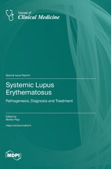 Systemic Lupus Erythematosus