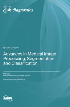 Advances in Medical Image Processing Segmentation and Classification