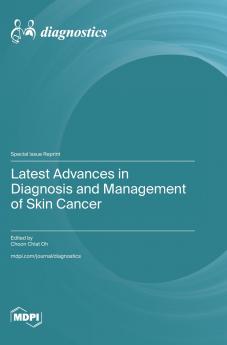 Latest Advances in Diagnosis and Management of Skin Cancer
