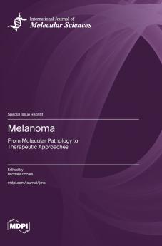 Melanoma