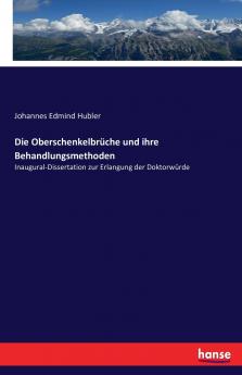Die Oberschenkelbrüche und ihre Behandlungsmethoden