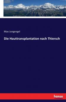 Die Hauttransplantation nach Thiersch