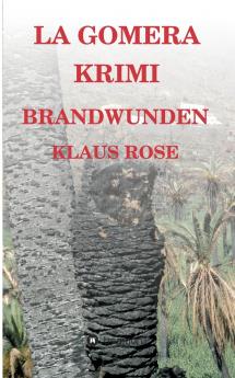 Brandwunden