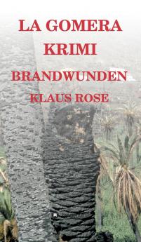 Brandwunden