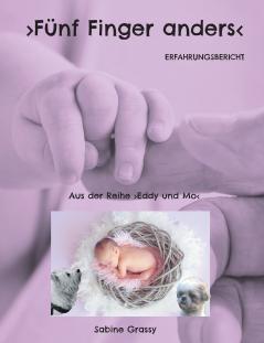 Fünf Finger anders
