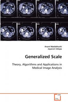Generalized Scale