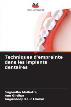 Techniques d'empreinte dans les implants dentaires