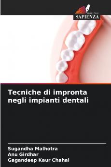 Tecniche di impronta negli impianti dentali