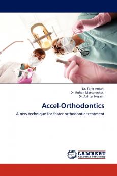 Accel-Orthodontics
