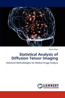 Statistical Analysis of Diffusion Tensor Imaging