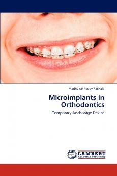 Microimplants in Orthodontics