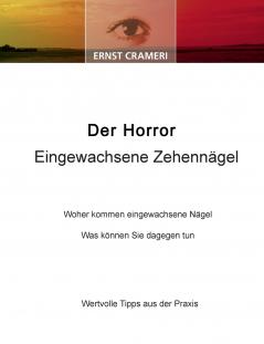Der Horror Eingewachsene Zehennägel