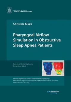 Pharyngeal Airflow Simulation in Obstructive Sleep Apnea Patients