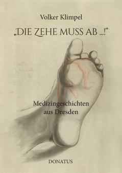 Die Zehe muss ab ...!