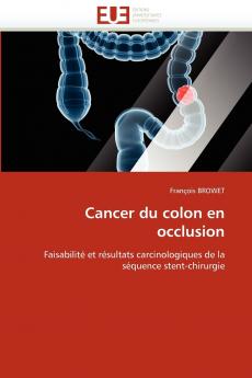 Cancer du colon en occlusion