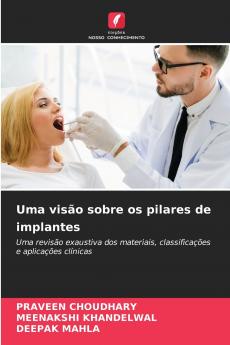 Uma visão sobre os pilares de implantes