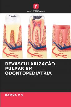REVASCULARIZAÇÃO PULPAR EM ODONTOPEDIATRIA