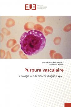 Purpura vasculaire